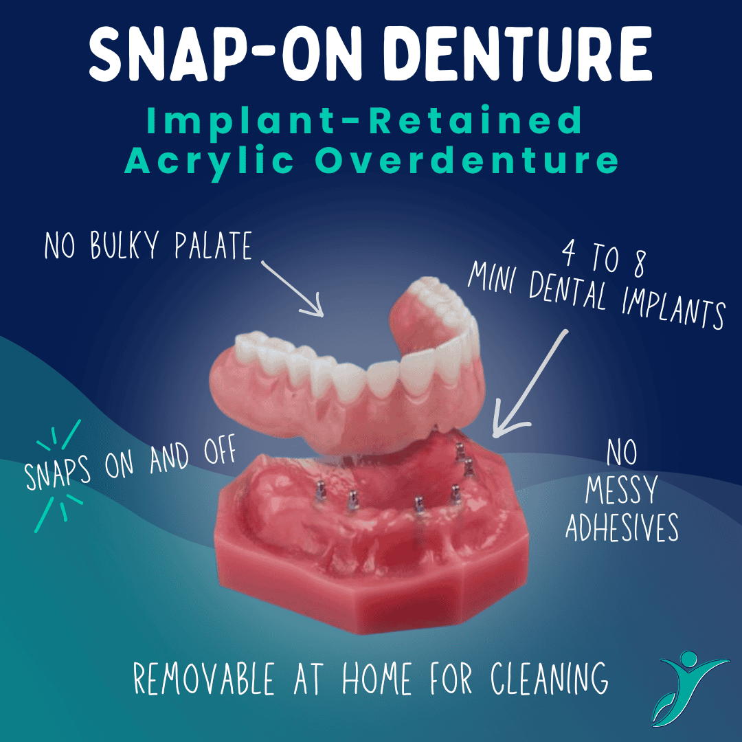 Snap on Denture in Scottsdale, AZ