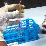 oxalate-test