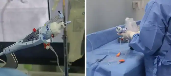 Posso Conseguir o MitraClip pelo Plano de Saúde? SIM! Posso Conseguir o MitraClip pelo Plano de Saúde? SIM!