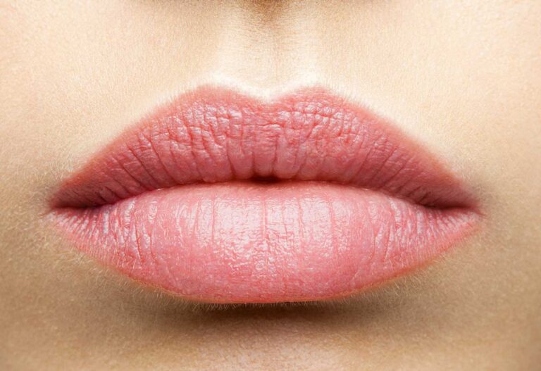 Chirurgie esthétique des lèvres (lifting lèvre supérieure)