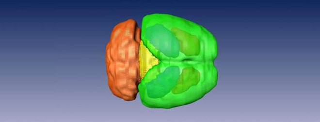 This image shows a 3-D reconstruction of a mouse brain based on magnetic resonance imaging (MRI). The forebrain is seen in green, the midbrain in yellow and the cerebellum in orange.
