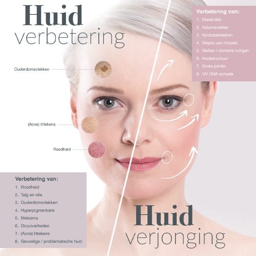 Huidverbetering Huidverjonging