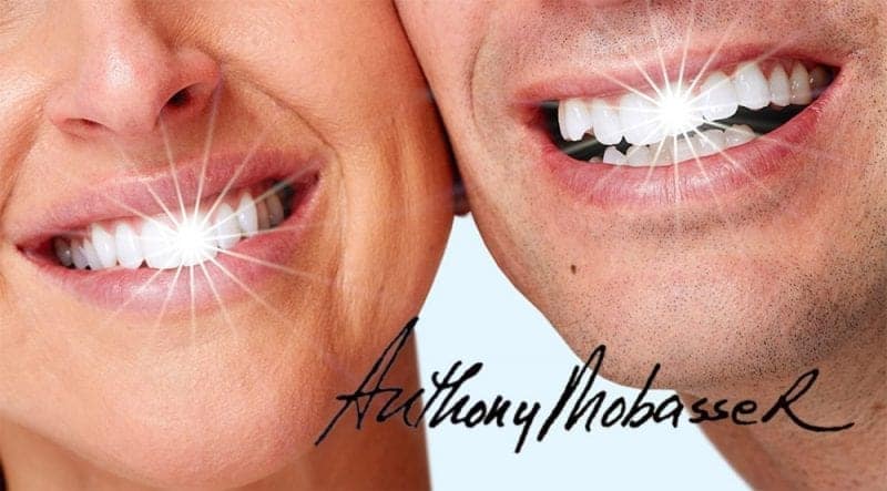 Dental Veneers in Beverly Hills