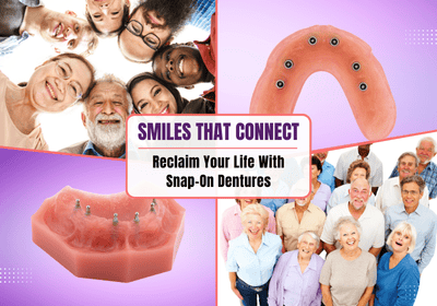 Snap-On Dentures | Removable Dentures in Rocklin, CA