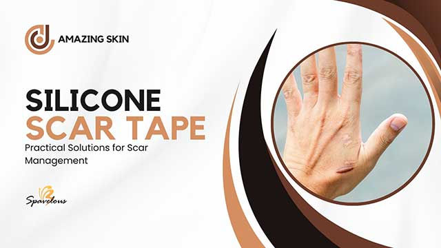 SCAR TAPE MAGIC: SECRET WEAPON FOR AMAZING SKIN RESULTS 4 effectiveness and scientific support