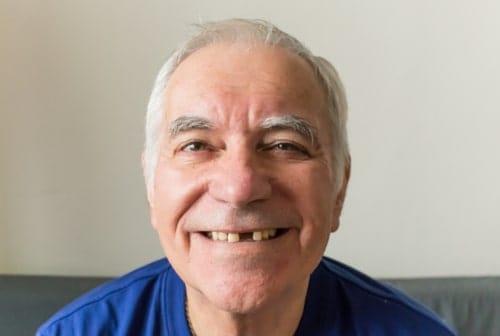 Tooth Implants Your Solution For Missing Teeth in Las Vegas