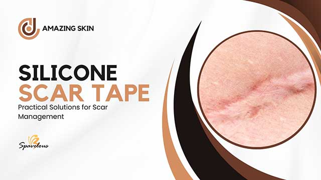 SCAR TAPE MAGIC: SECRET WEAPON FOR AMAZING SKIN RESULTS 3 choosing your solution