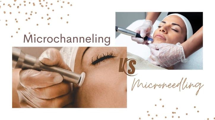 microchanneling vs microneedling