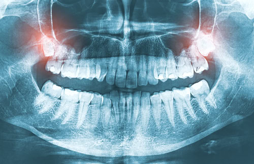 Digital Radiography in Melbourne, FL Dr. Victor C Apel
