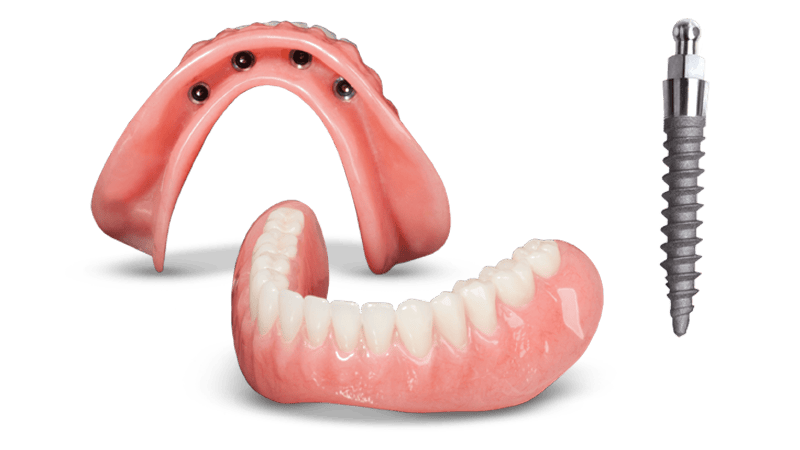 Mini Dentures in Wayne, NJ | Denture Options | Dental Implants