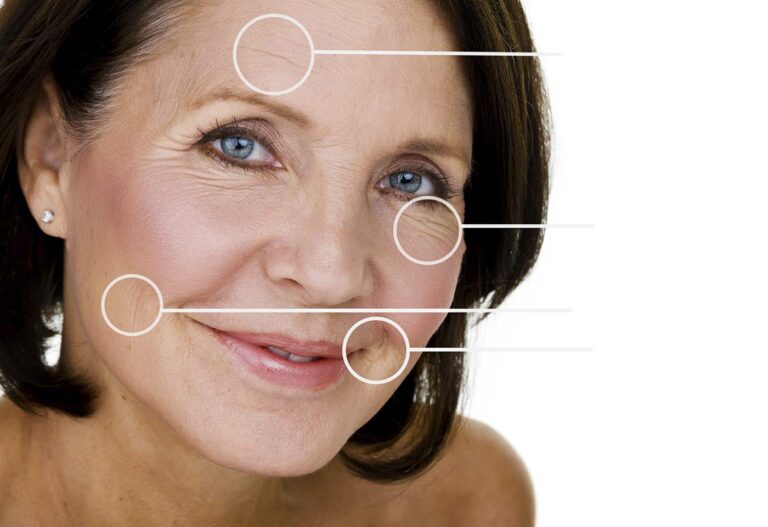 Injection Botox à Paris