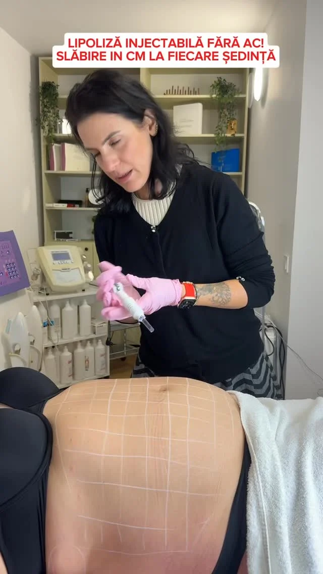 ✨Fără ace, fără durere, dar cu grăsimea topită? Da, există!
Nu, nu e magie. E lipoliză injectabilă fără ac și funcționează❗️
💉Ți-e frică de ace? Atunci o să iubești asta.
Grăsime încăpățânată pe abdomen ❓Uită de injecții!
Dacă vrei și tu, scrie " VREAU " in comentarii și eu revin către tine cu toate detaliile si programare. 
#angelrosesalon #lipolizafaraac #foryoupage❤️❤️ #remodelarecorporala #bucuresti