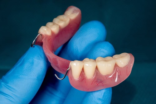 Partial Dentures in Cleveland, TN | Try a Dental Implant Alternative