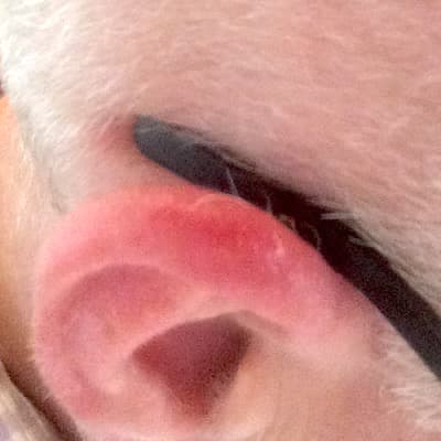 Aktinischer Keratose Foto - oben am Ohr