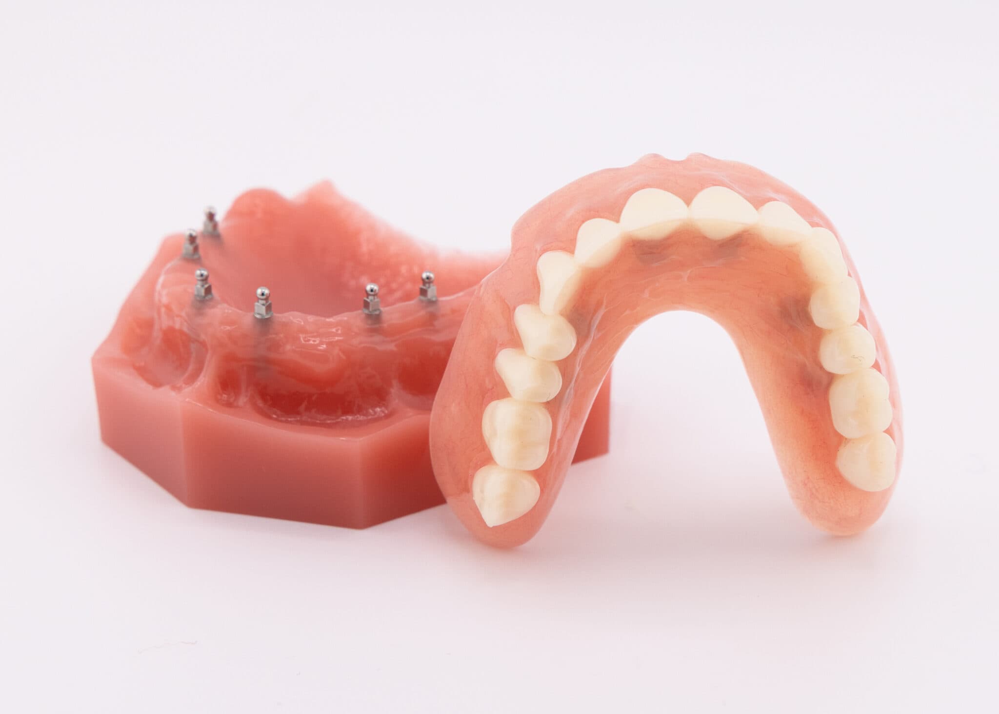 Snap On Dentures in Las Vegas, NV | Book a Free Consultation