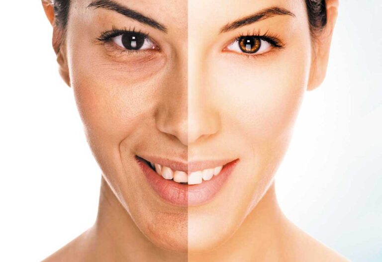 Chirurgie esthétique du visage à paris