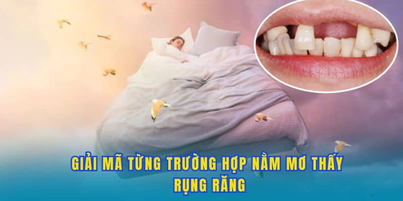 Giải mã cụ thể từng trường hợp nằm mơ thấy rụng răng.