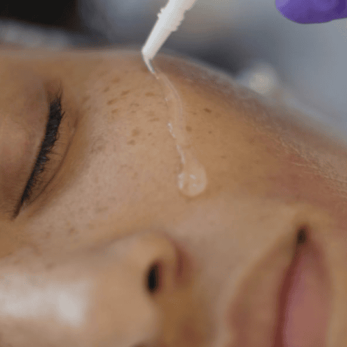 DT Treatment - Subjectable