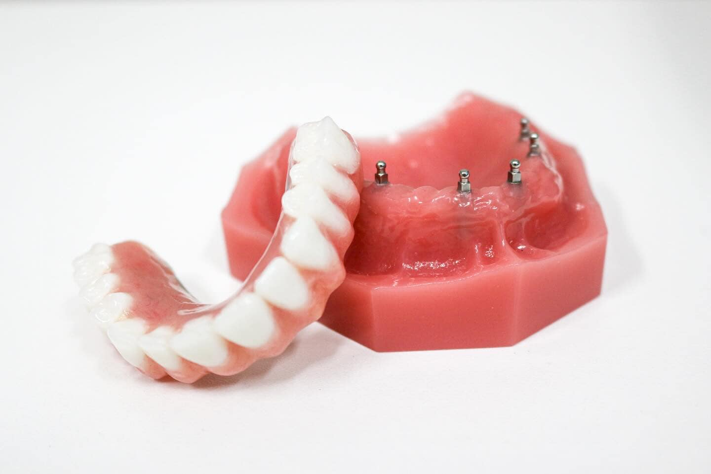 Full and Partial Dentures in Las Vegas, NV | Free Consultations