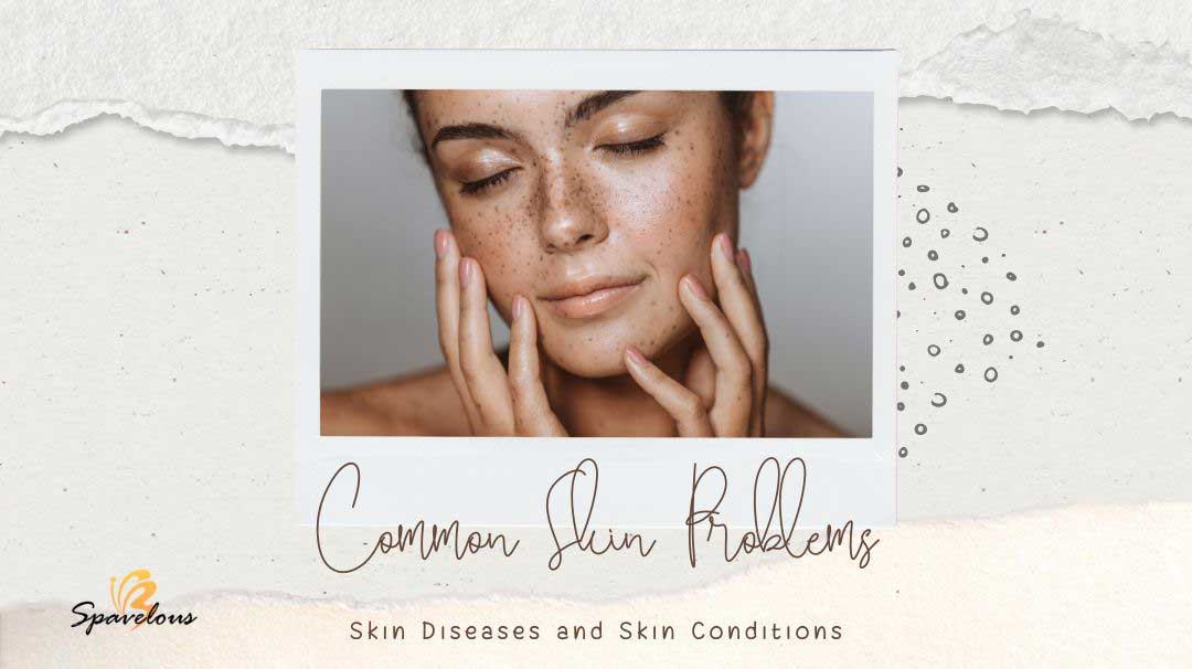 SKIN CONDITIONS AND SOLUTIONS 34 common skin problems