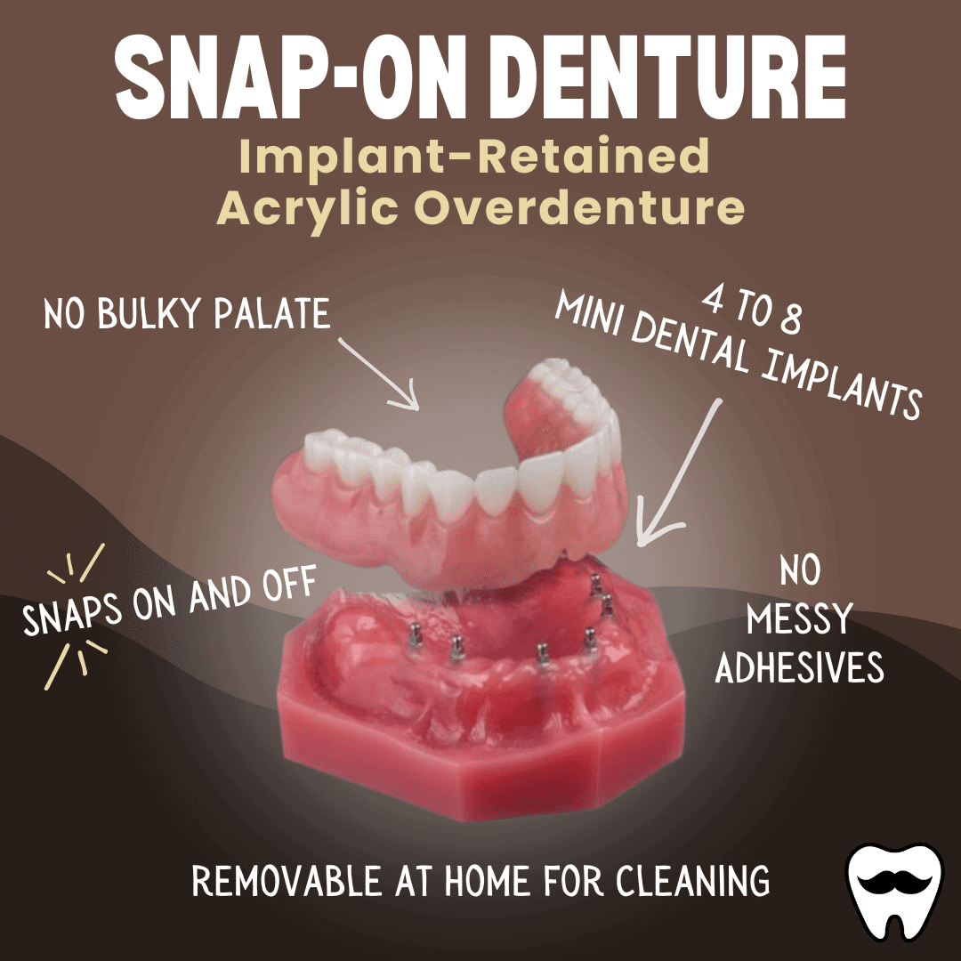 Snap On Dentures in Atkins, AR
