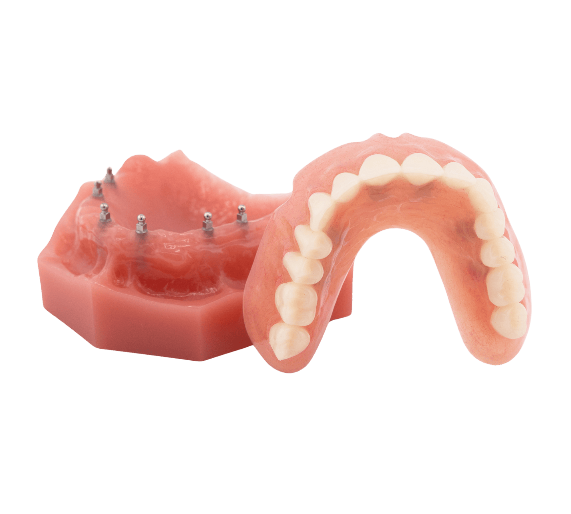 Implant Dentures Cost in Syracuse, NY | Discover Mini Implant Dentures