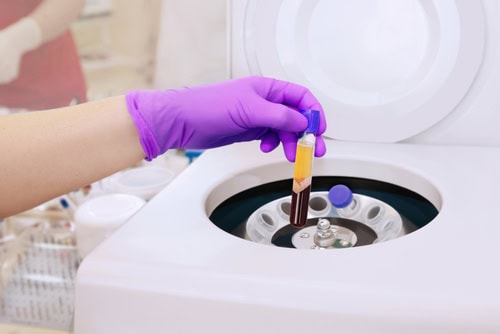 L-PRF Therapy | Oral Surgery in Idaho Falls, ID | West Wind Dental