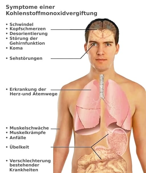 symptome kohlenmonoxid vergiftung