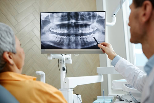 Full Mouth Reconstruction in Dunn, NC | Restore Your Smile Today!