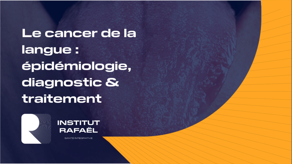 Cancer de la langue symptôme, diagnostic et traitement — free download