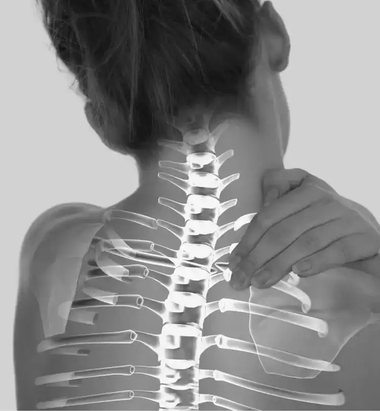an illustration of a spinal cord injury
