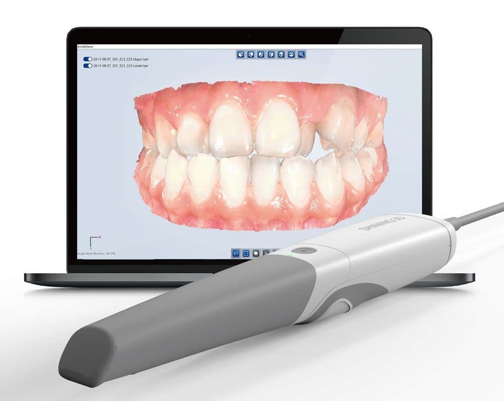 3D Dental Imaging Intraoral Scanning Mint Mini Dental Implants