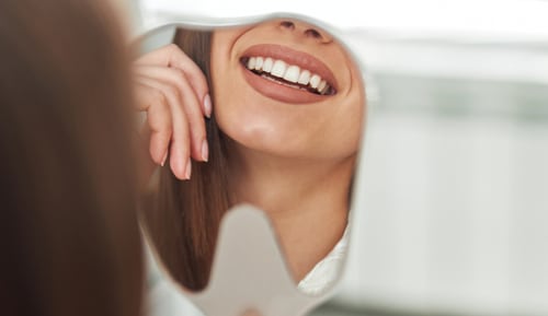 Permanent Teeth Whitening in North Carolina | Porcelain Veneers