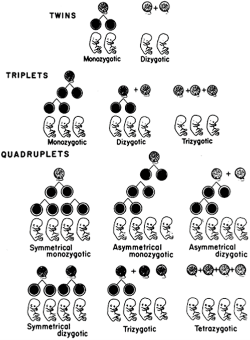 zygosity for higher order multiples icombo international council of multiple birth organisations