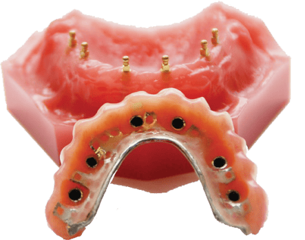 Denture Options in Wayne, NJ | Book a Free Consultation