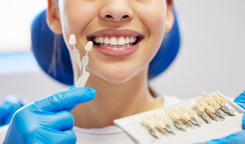 Veneers in Wayne, NJ | Revitalize Your Smile at Fine Dental Care