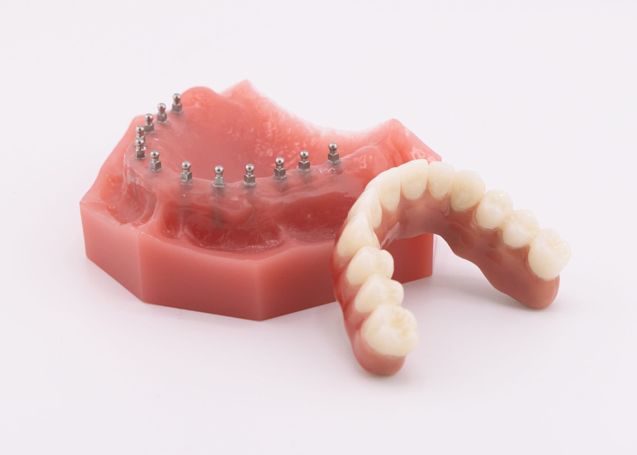 Full Arch Dental Implants in Buffalo, NY | Free Consultations