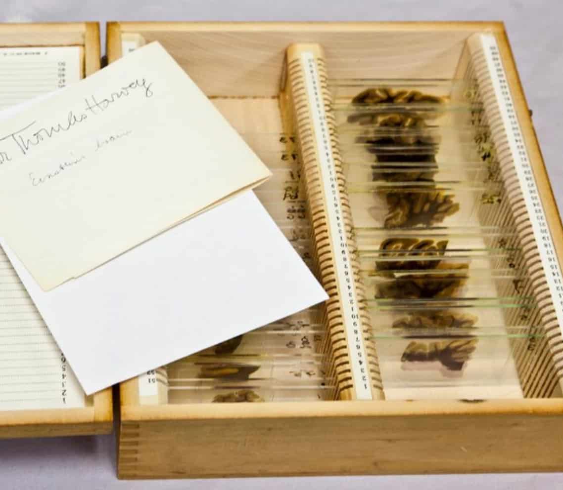 Der Diebstahl von Einsteins Gehirn 4 Der Diebstahl von Einsteins Gehirn 4