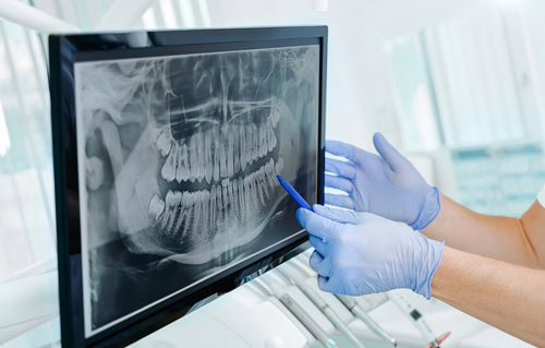 Oral Surgery in Winston-Salem, NC | Dr. Matthew Keider