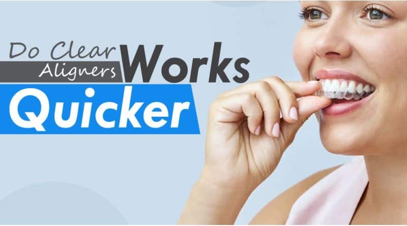 Do Quick Aligners Work Quicker