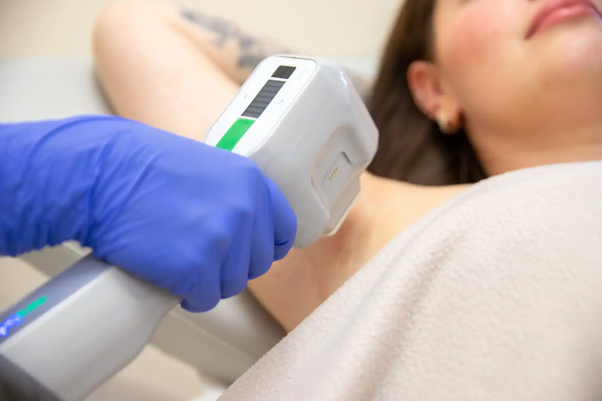 Miradry Lasermedizin Dermatologie Muenchen Sendlinger Tor