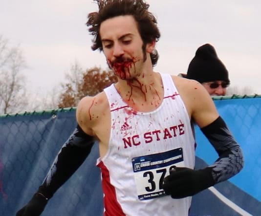 Man, Not Meme, Eli Moskowitz Recovering After NCAA XC Accident