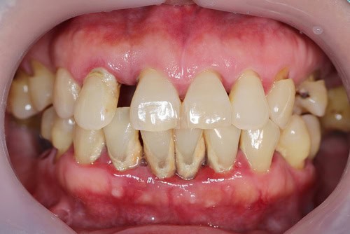 Periodontal Care in Scottsdale, AZ