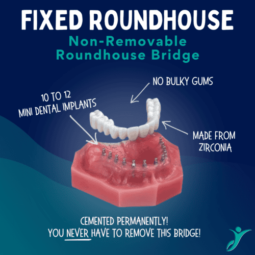 Mini Implantes Dentales en Las Vegas Dr. Harvey Chin