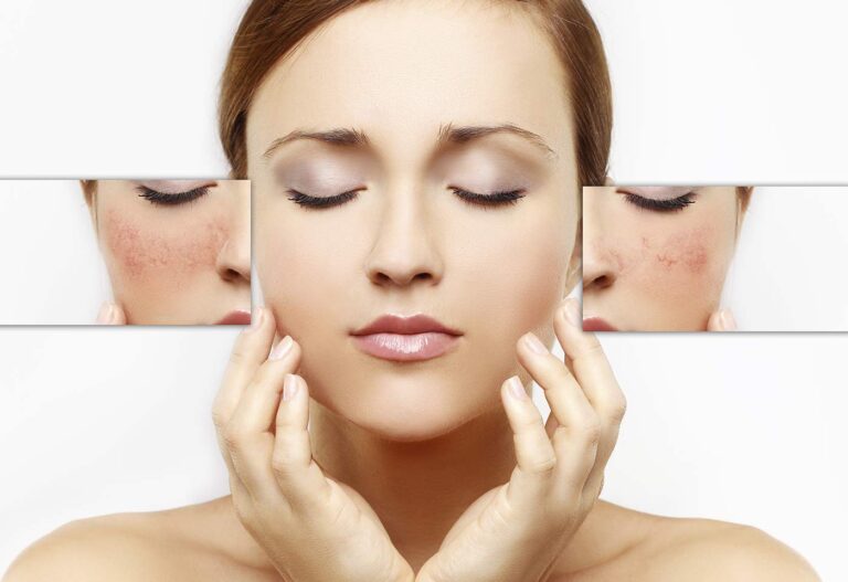 Peeling du visage à Paris