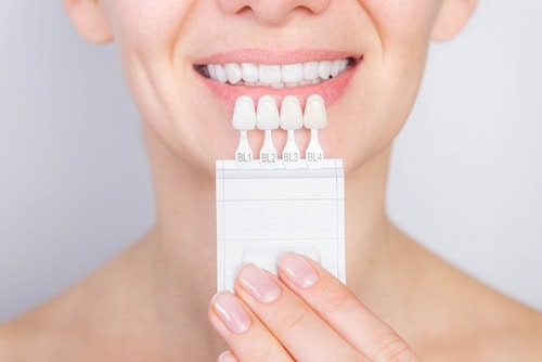 Instant Orthodontics in Pittsburgh, PA | Affordable Veneers Near Me