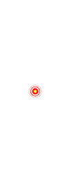 OSMO Patch Baker's Cyst