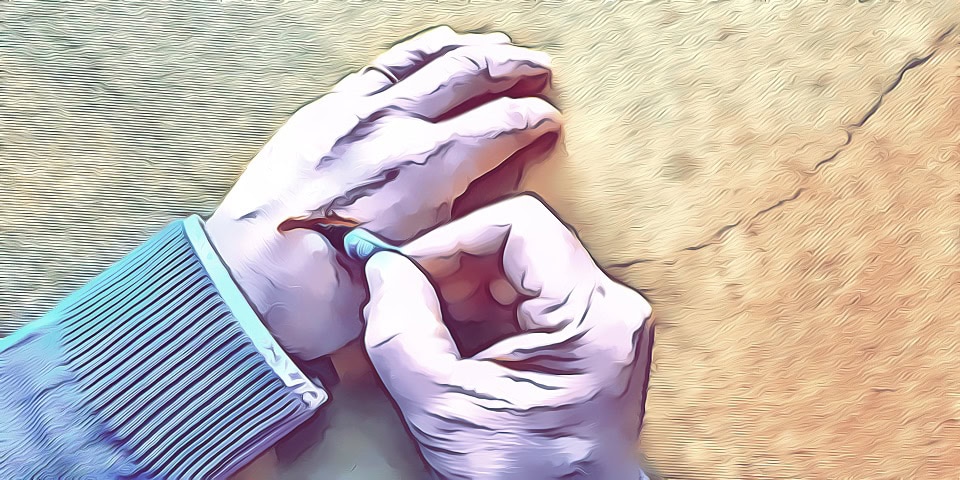 Wunde kleben - Ratgeber