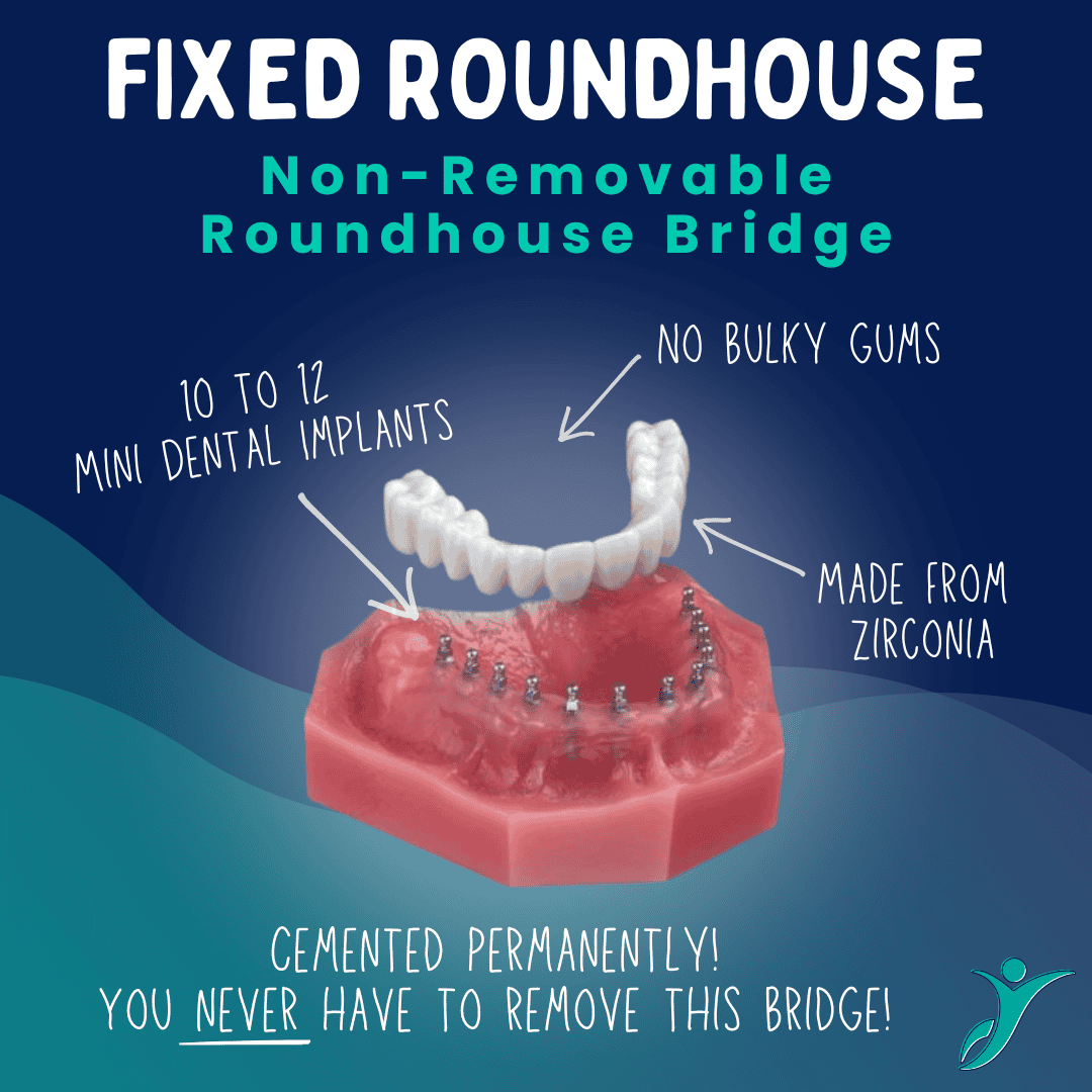 Fixed Roundhouse Bridge in Scottsdale, AZ