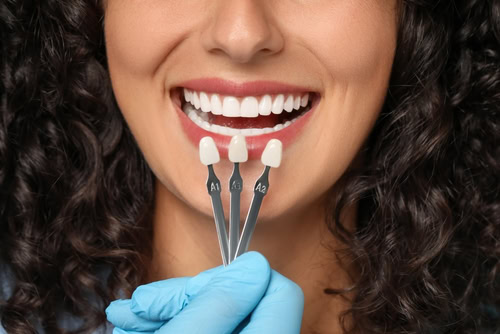Permanent Teeth Whitening in Cleveland, TN | Porcelain Veneers